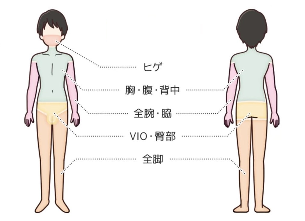 男性の正面と背面に、ヒゲ、胸・腹・背中、全腕・脇、VIO・臀部、全脚の施術範囲を色分けした図